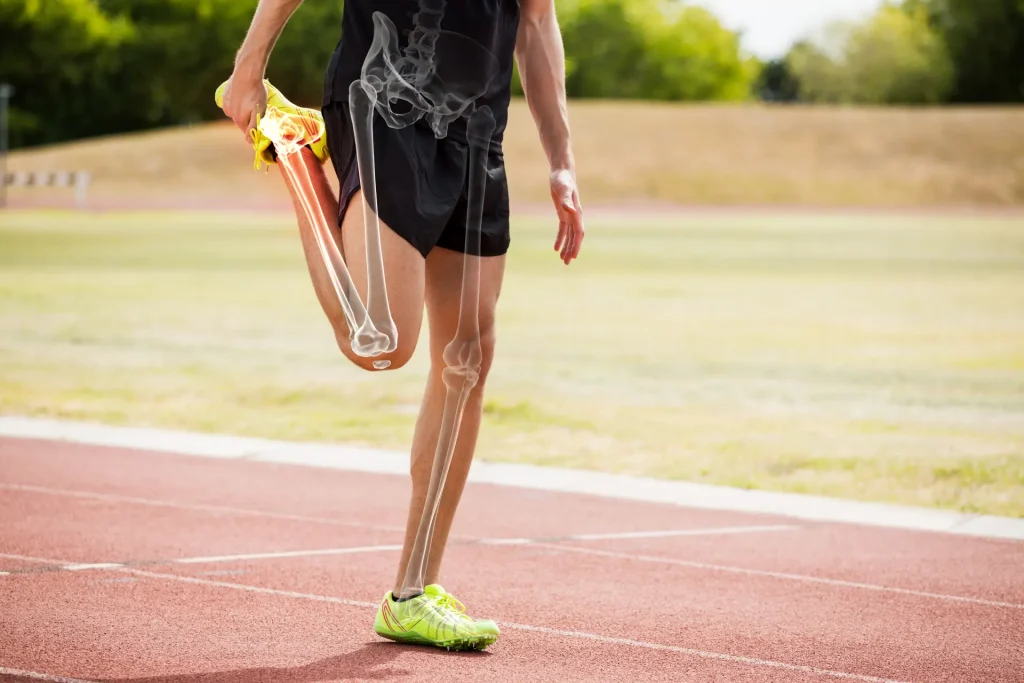 Reducing The Risk of Running Injuries: Your Comprehensive Guide to Prevention