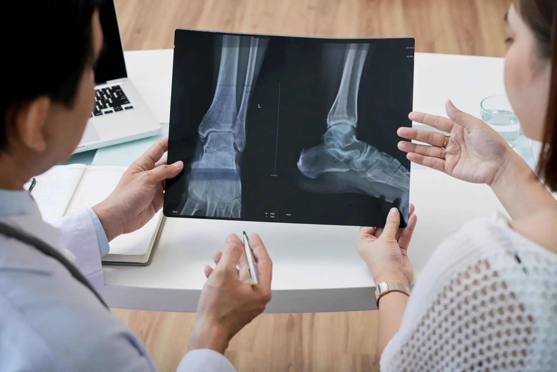 Understanding Foot Fractures: Causes, Symptoms and Treatment Options